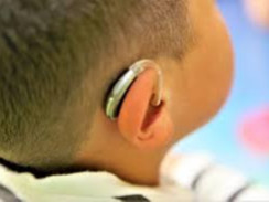 Сонсголгүй иргэдийг сонсголтой болгож эхэлсний 10 жилийн ой тохиож байна